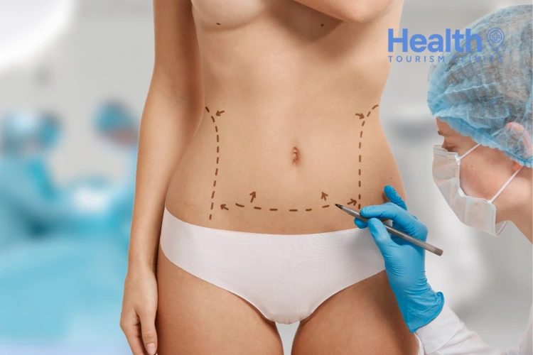 Can Liposuction Remove Cellulite?