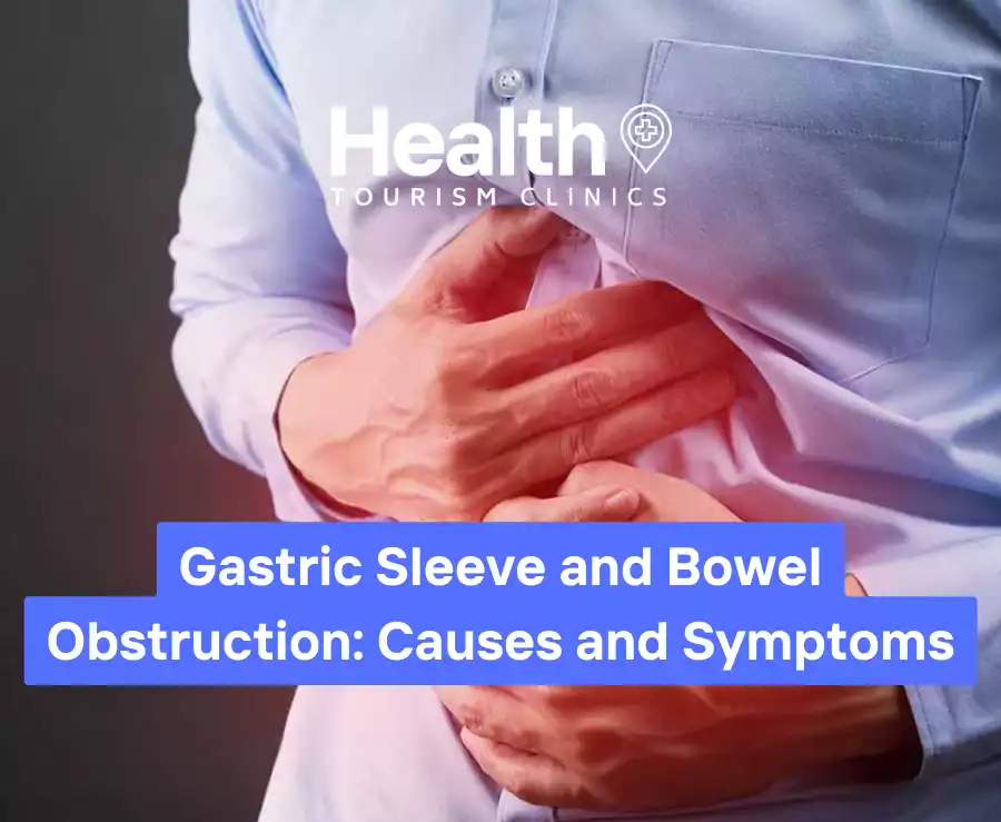 Gastric Sleeve and Bowel Obstruction: Causes and Symptoms – 2023