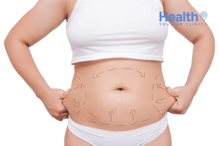 Abdominoplasty in Turkey – 2023 Price & Review Clinics