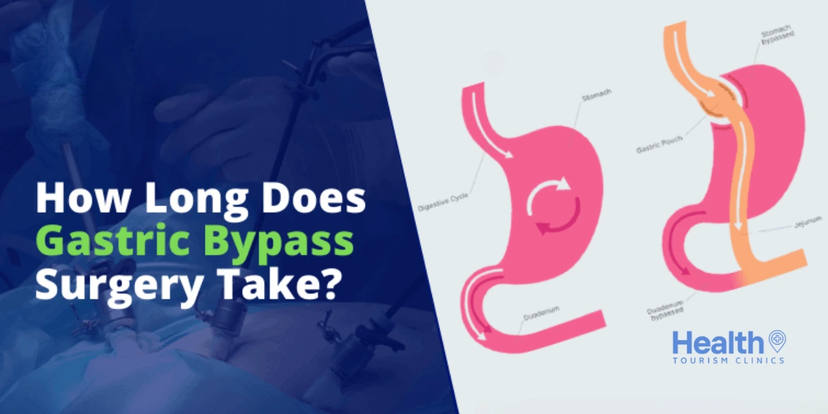 What Is Gastric Sleeve Surgery?