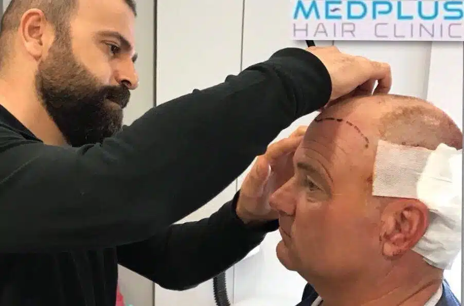 medplus hair clinic turkey 0