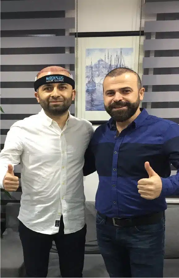 medplus hair clinic turkey 1