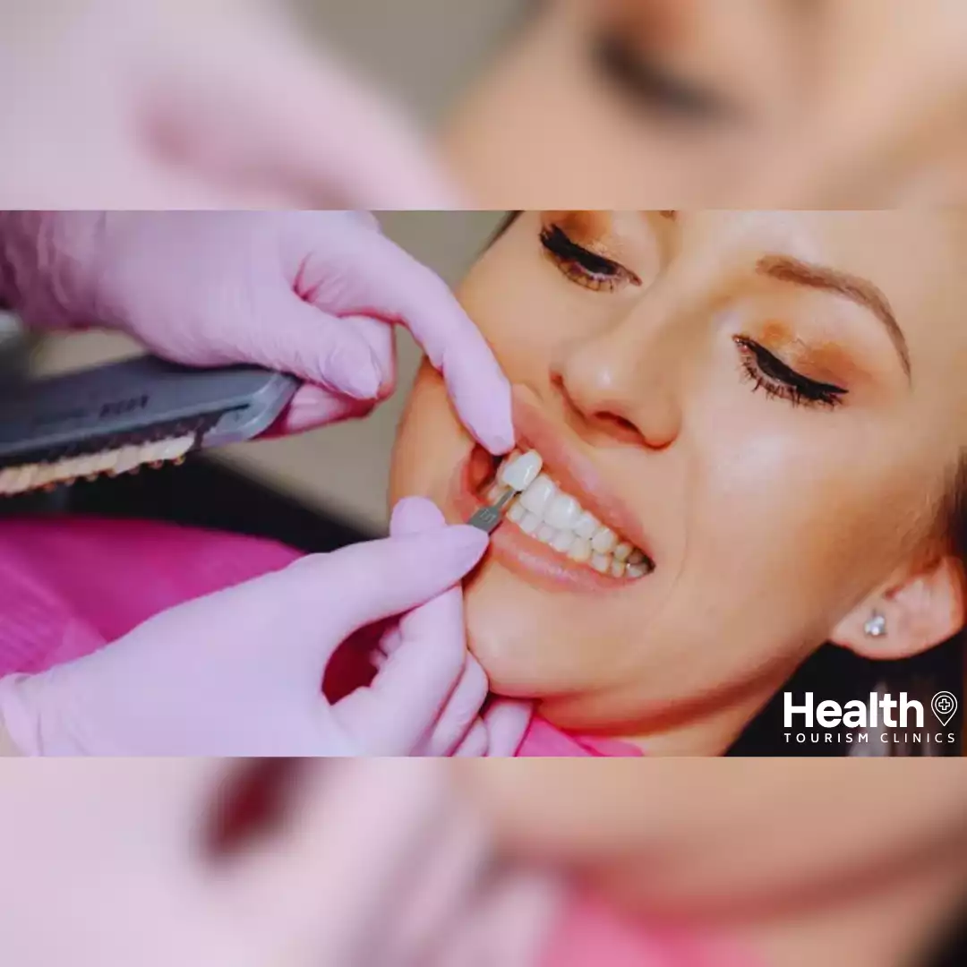 Zirkonyum Diş Kaplama Sonrası Diş Renginde Değişim Olur Mu?