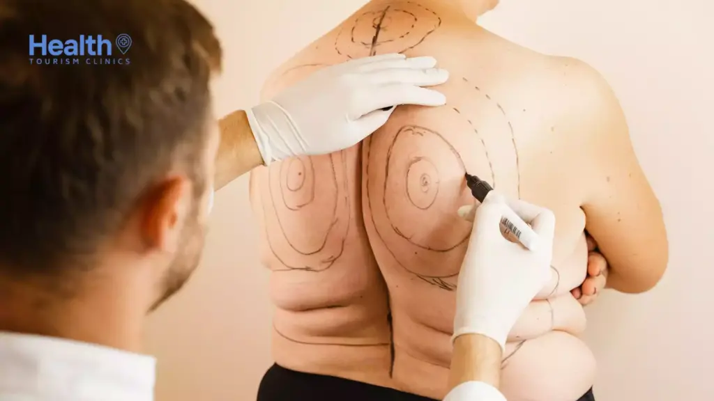 Liposuction Ameliyatı Öncesi Beslenme