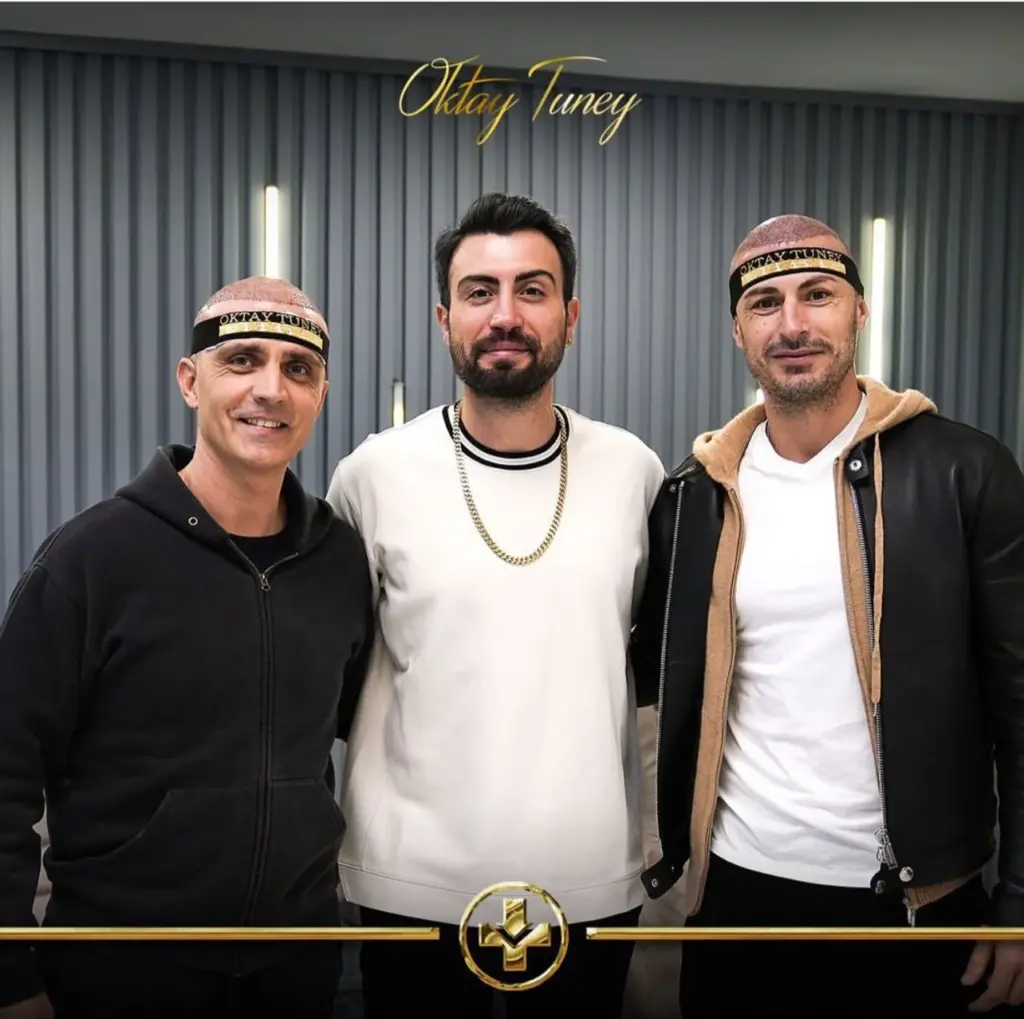 Oktay Tüney Hair Transplant