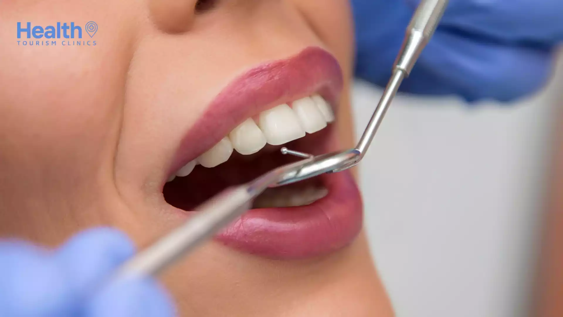 En İyi Zirkonyum Diş Kaplama Klinikleri