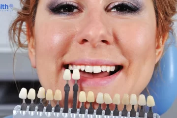 How Much do Veneers Cost in Turkey? (Best Prices)