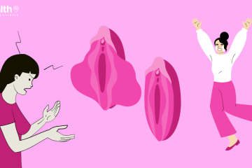 Vaginoplasty in Turkey (Best Cost 2025)